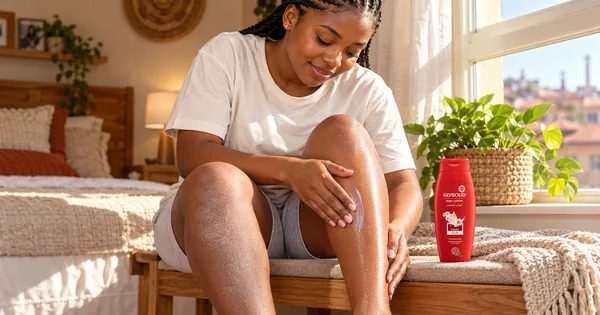A teenager in Soweto smoothing Glysolid Body Lotion Classic onto her dry, ashy knees.